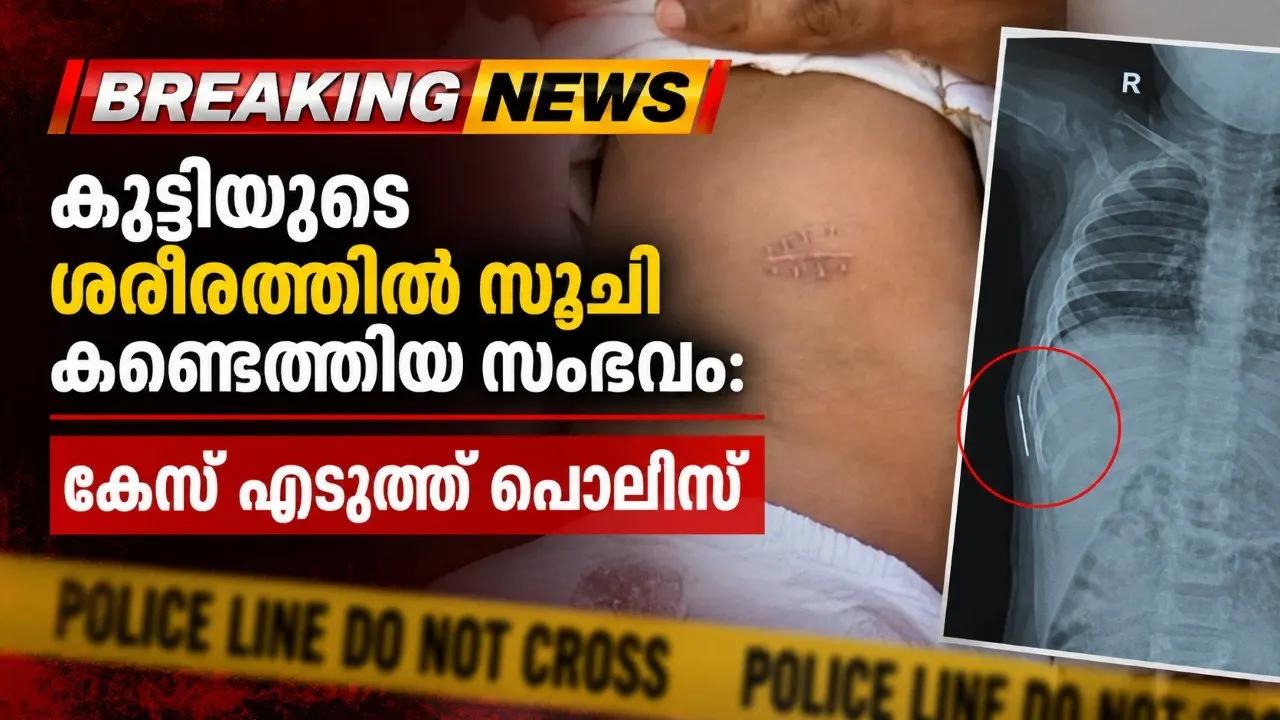 കുട്ടിയുടെ ശരീരത്തില്‍ സൂചി കണ്ടെത്തിയ സംഭവം: കേസ് എടുത്ത് പൊലീസ്