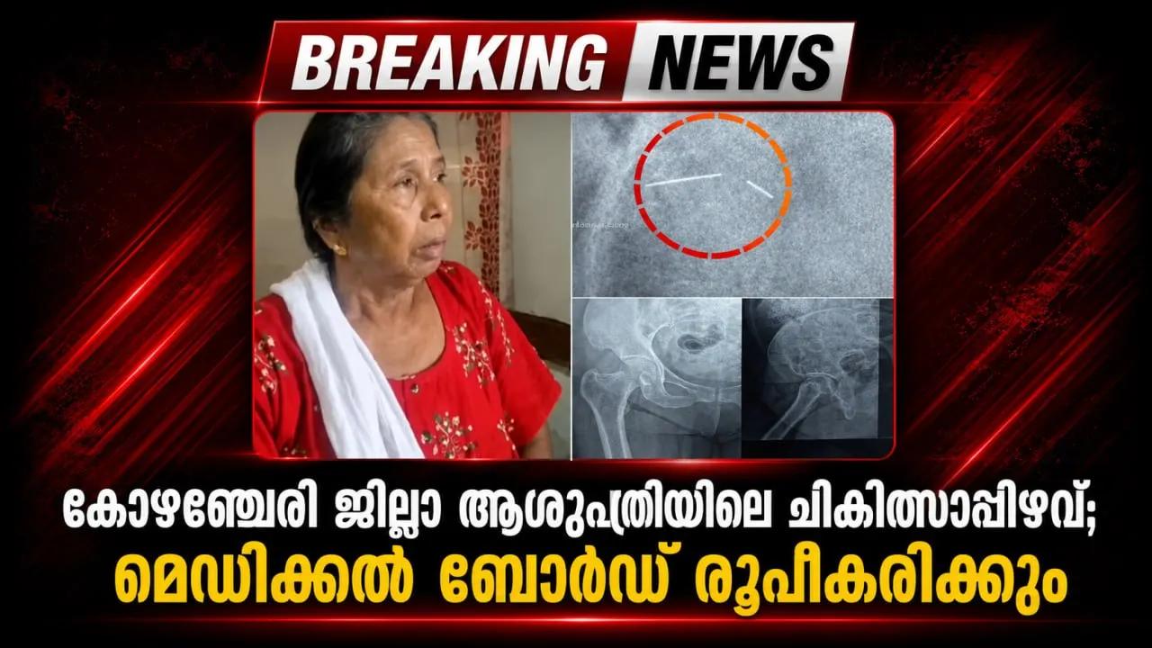 കോഴഞ്ചേരി ജില്ലാ ആശുപത്രിയിലെ ചികിത്സാപ്പിഴവ്; മെഡിക്കൽ ബോർഡ്‌ രൂപീകരിക്കും
